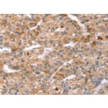 Immunohistochemistry - TBC1D1 Antibody from Signalway Antibody (43157) - Antibodies.com