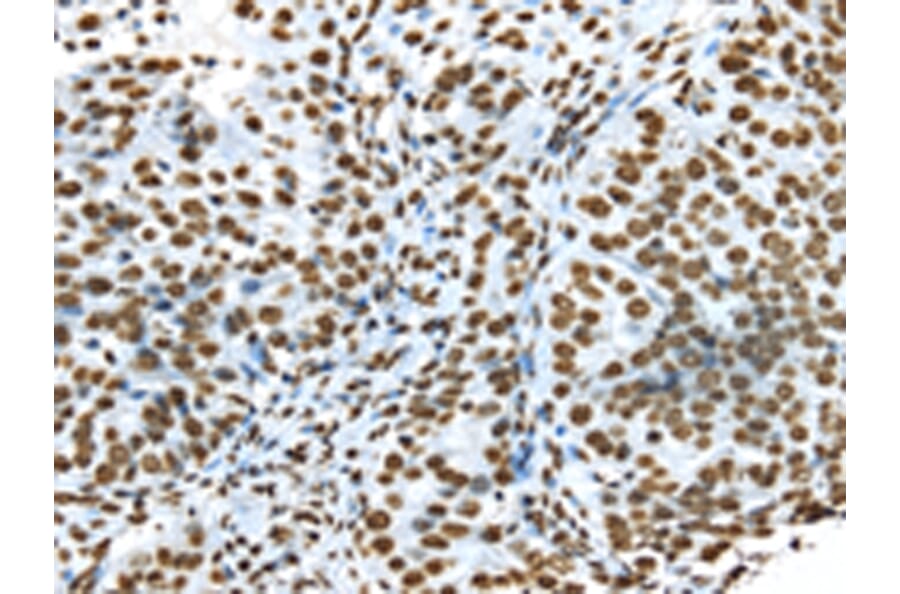 Immunohistochemistry - TRIM27 Antibody from Signalway Antibody (43159) - Antibodies.com