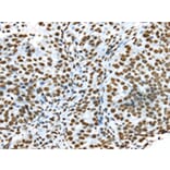 Immunohistochemistry - TRIM27 Antibody from Signalway Antibody (43159) - Antibodies.com