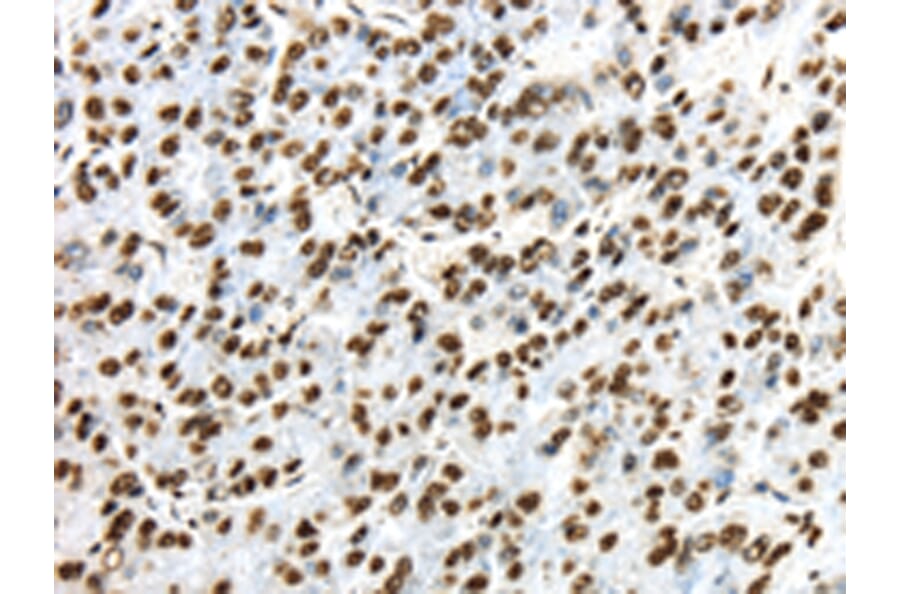 Immunohistochemistry - TRIM27 Antibody from Signalway Antibody (43159) - Antibodies.com