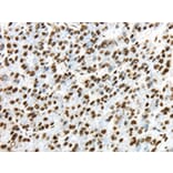 Immunohistochemistry - TRIM27 Antibody from Signalway Antibody (43159) - Antibodies.com