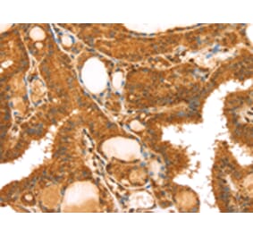 Immunohistochemistry - TRIM25 Antibody from Signalway Antibody (43160) - Antibodies.com