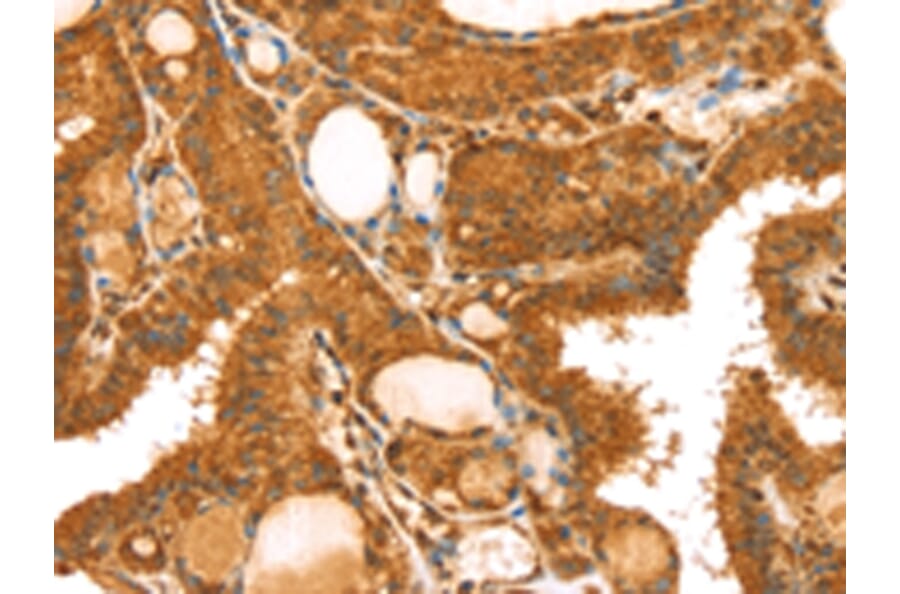 Immunohistochemistry - TRIM25 Antibody from Signalway Antibody (43160) - Antibodies.com