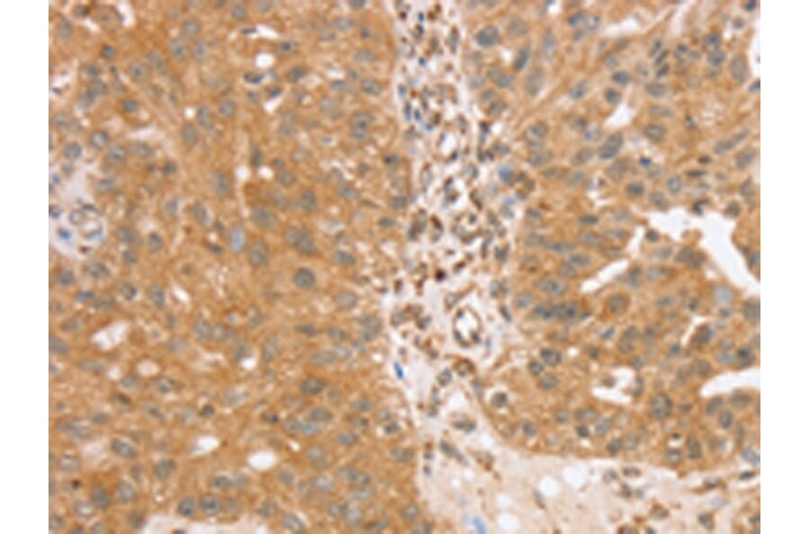Immunohistochemistry - TRIM25 Antibody from Signalway Antibody (43160) - Antibodies.com