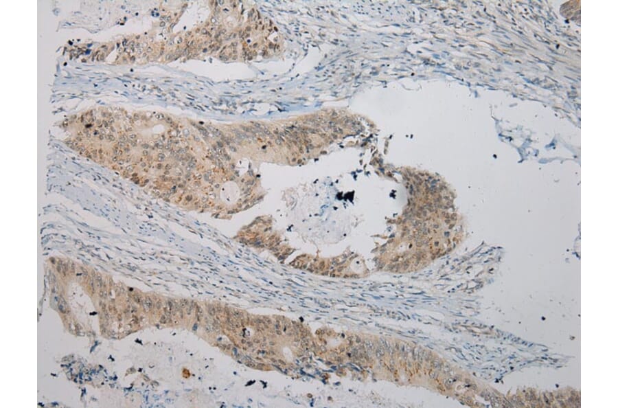 Immunohistochemistry - UGT1A6 Antibody from Signalway Antibody (43176) - Antibodies.com