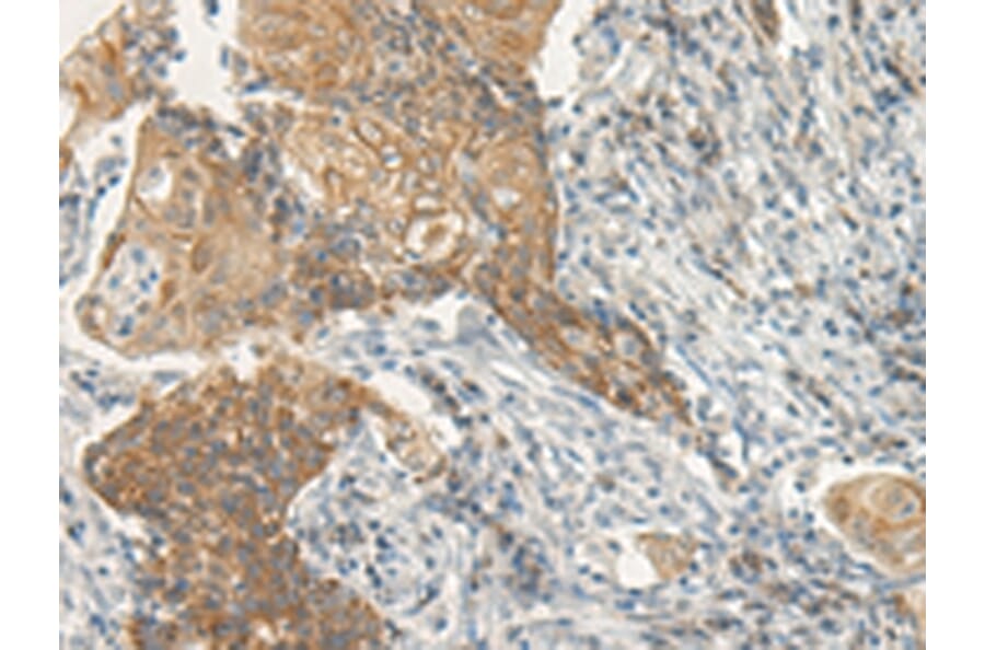 Immunohistochemistry - VIPR2 Antibody from Signalway Antibody (43181) - Antibodies.com