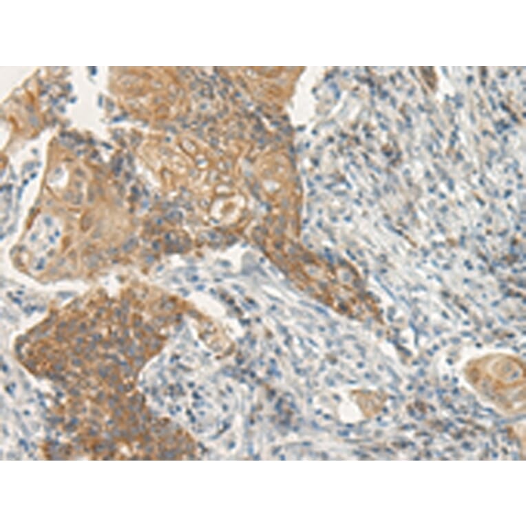 Immunohistochemistry - VIPR2 Antibody from Signalway Antibody (43181) - Antibodies.com