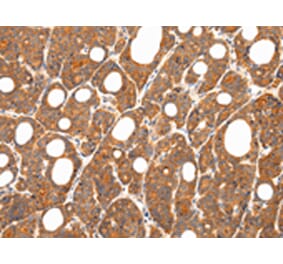 Immunohistochemistry - ZNF281 Antibody from Signalway Antibody (43208) - Antibodies.com