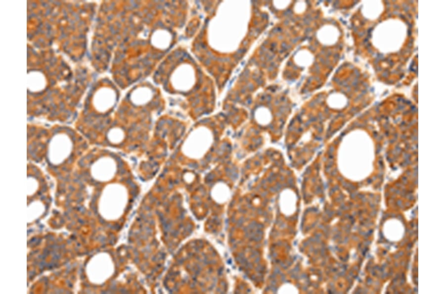 Immunohistochemistry - ZNF281 Antibody from Signalway Antibody (43208) - Antibodies.com