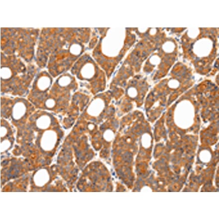 Immunohistochemistry - ZNF281 Antibody from Signalway Antibody (43208) - Antibodies.com