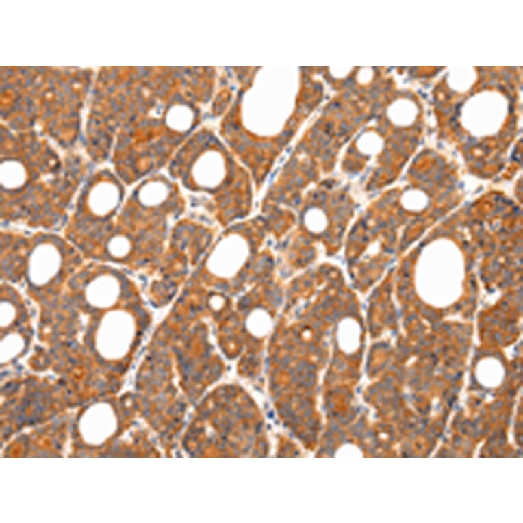 Immunohistochemistry - ZNF281 Antibody from Signalway Antibody (43208) - Antibodies.com