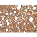 Immunohistochemistry - ZNF281 Antibody from Signalway Antibody (43208) - Antibodies.com