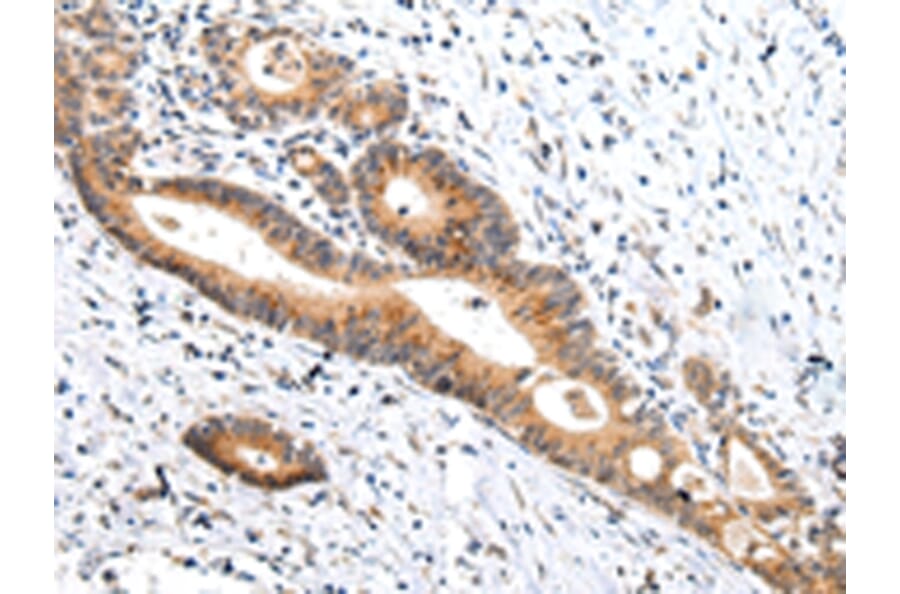 Immunohistochemistry - ZNF281 Antibody from Signalway Antibody (43208) - Antibodies.com