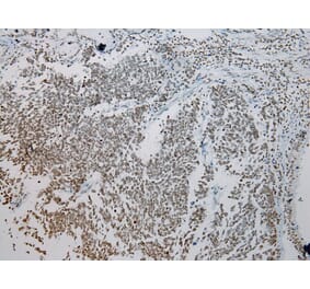 Immunohistochemistry - ZNF200 Antibody from Signalway Antibody (43209) - Antibodies.com