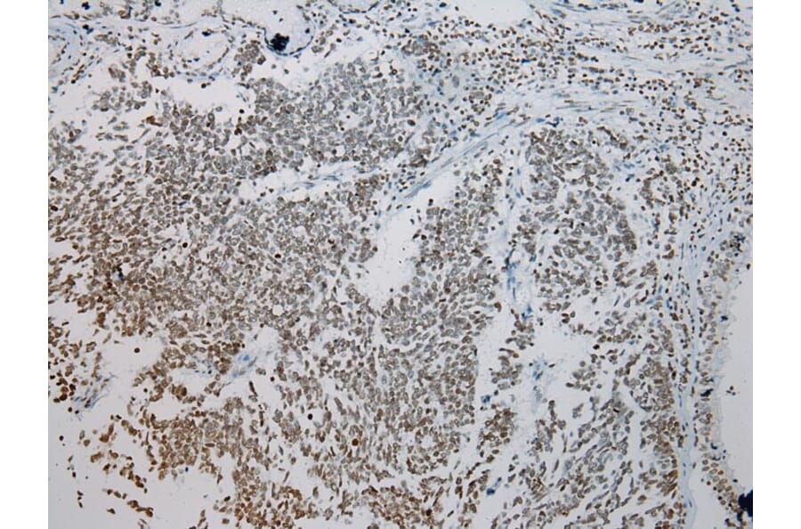 Immunohistochemistry - ZNF200 Antibody from Signalway Antibody (43209) - Antibodies.com