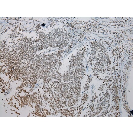 Immunohistochemistry - ZNF200 Antibody from Signalway Antibody (43209) - Antibodies.com