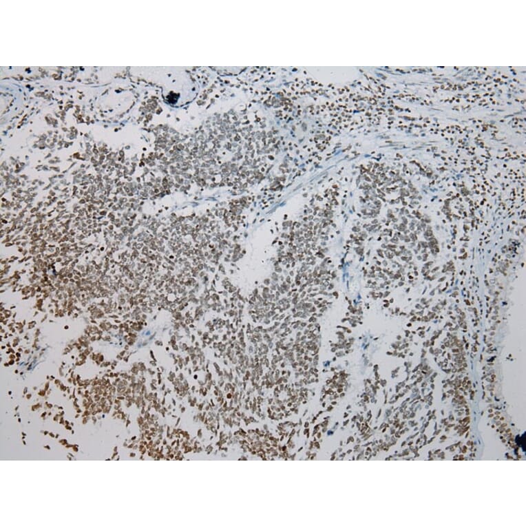 Immunohistochemistry - ZNF200 Antibody from Signalway Antibody (43209) - Antibodies.com