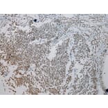 Immunohistochemistry - ZNF200 Antibody from Signalway Antibody (43209) - Antibodies.com