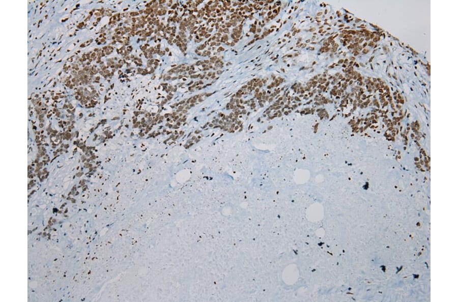 Immunohistochemistry - ZNF200 Antibody from Signalway Antibody (43209) - Antibodies.com
