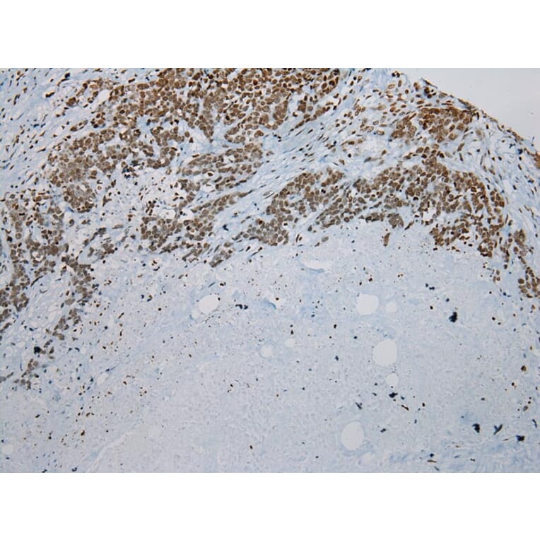 Immunohistochemistry - ZNF200 Antibody from Signalway Antibody (43209) - Antibodies.com