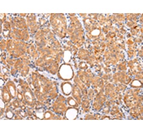 Immunohistochemistry - ZNF420 Antibody from Signalway Antibody (43213) - Antibodies.com