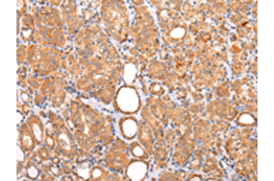 Immunohistochemistry - ZNF420 Antibody from Signalway Antibody (43213) - Antibodies.com