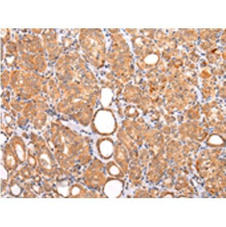 Immunohistochemistry - ZNF420 Antibody from Signalway Antibody (43213) - Antibodies.com