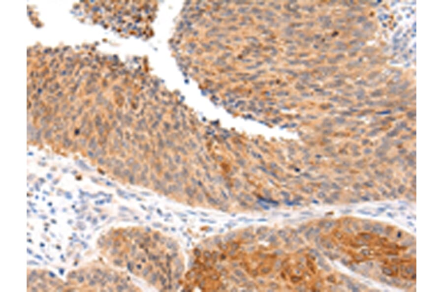 Immunohistochemistry - ZNF420 Antibody from Signalway Antibody (43213) - Antibodies.com