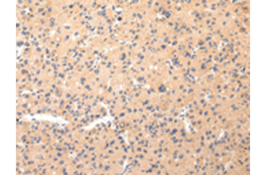 Immunohistochemistry - COL8A2 Antibody from Signalway Antibody (43219) - Antibodies.com