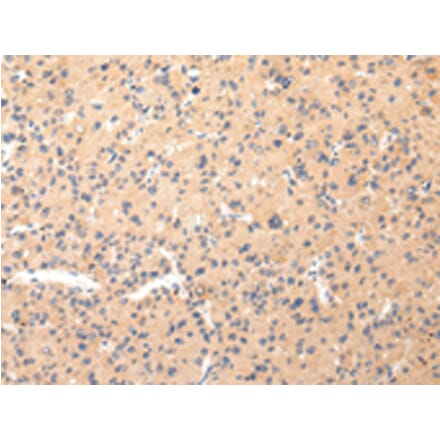 Immunohistochemistry - COL8A2 Antibody from Signalway Antibody (43219) - Antibodies.com