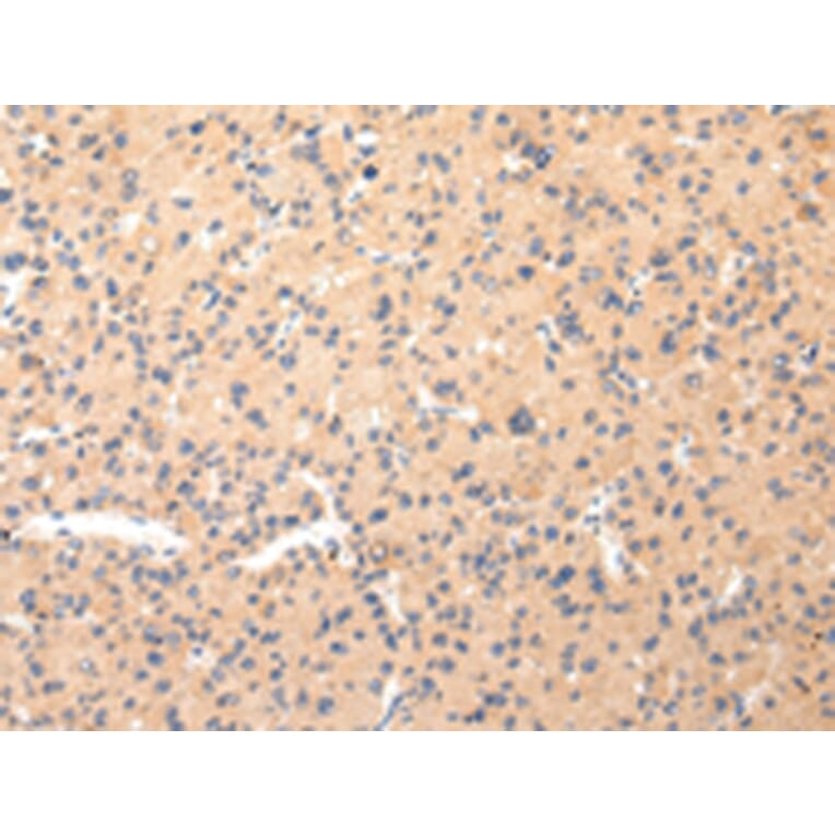 Immunohistochemistry - COL8A2 Antibody from Signalway Antibody (43219) - Antibodies.com