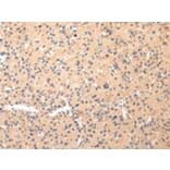Immunohistochemistry - COL8A2 Antibody from Signalway Antibody (43219) - Antibodies.com