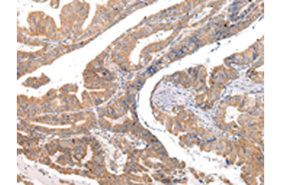 Immunohistochemistry - COL8A2 Antibody from Signalway Antibody (43219) - Antibodies.com