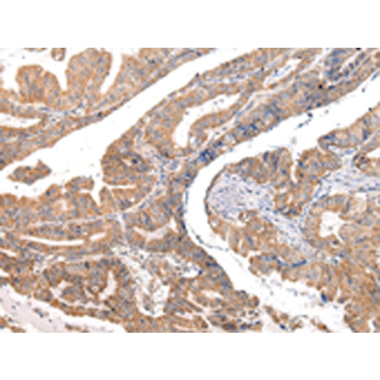 Immunohistochemistry - COL8A2 Antibody from Signalway Antibody (43219) - Antibodies.com