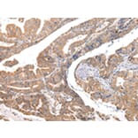 Immunohistochemistry - COL8A2 Antibody from Signalway Antibody (43219) - Antibodies.com