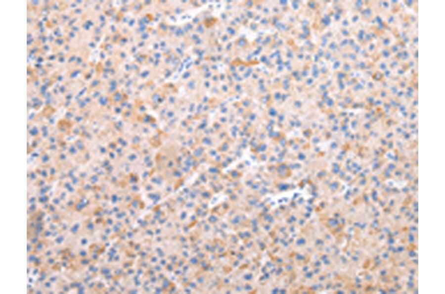 Immunohistochemistry - AXIN1 Antibody from Signalway Antibody (43229) - Antibodies.com