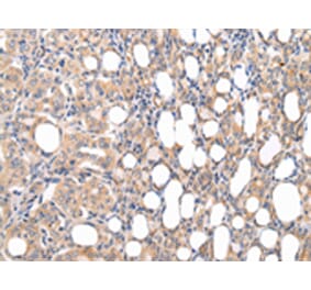 Immunohistochemistry - CMKLR1 Antibody from Signalway Antibody (43236) - Antibodies.com