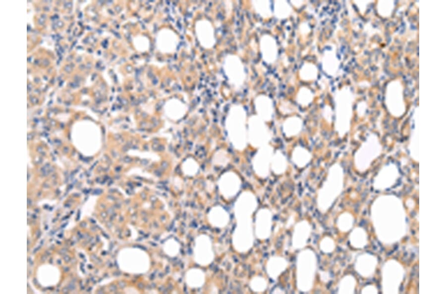 Immunohistochemistry - CMKLR1 Antibody from Signalway Antibody (43236) - Antibodies.com