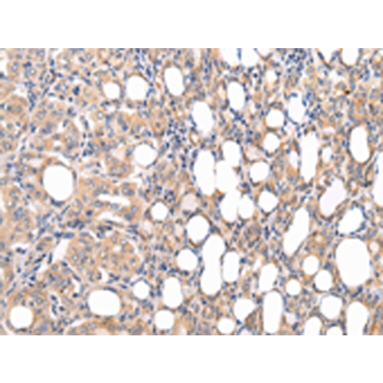 Immunohistochemistry - CMKLR1 Antibody from Signalway Antibody (43236) - Antibodies.com