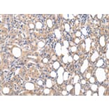Immunohistochemistry - CMKLR1 Antibody from Signalway Antibody (43236) - Antibodies.com