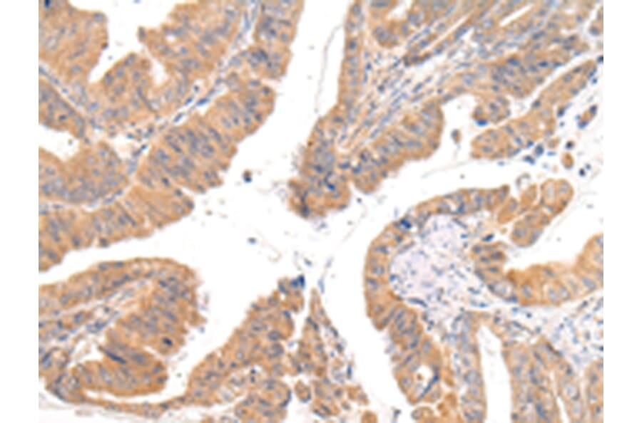 Immunohistochemistry - CMKLR1 Antibody from Signalway Antibody (43236) - Antibodies.com
