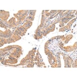Immunohistochemistry - CMKLR1 Antibody from Signalway Antibody (43236) - Antibodies.com