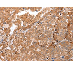 Immunohistochemistry - DEFB4A Antibody from Signalway Antibody (43259) - Antibodies.com