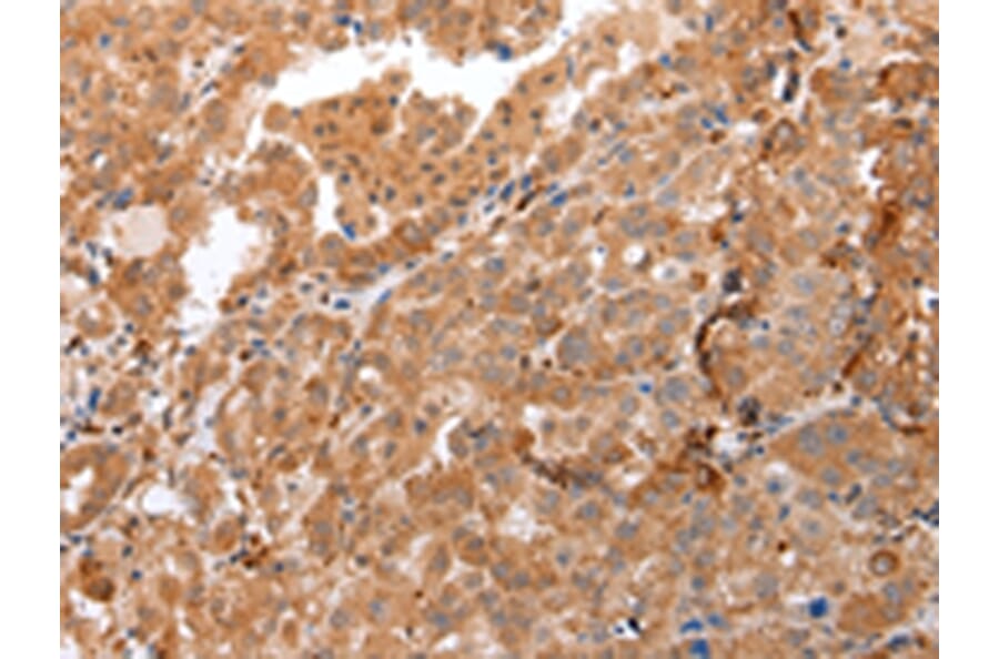 Immunohistochemistry - DEFB4A Antibody from Signalway Antibody (43259) - Antibodies.com