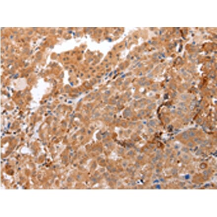 Immunohistochemistry - DEFB4A Antibody from Signalway Antibody (43259) - Antibodies.com