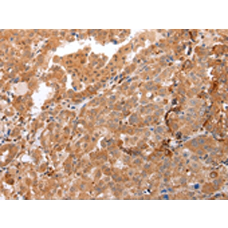 Immunohistochemistry - DEFB4A Antibody from Signalway Antibody (43259) - Antibodies.com