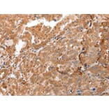 Immunohistochemistry - DEFB4A Antibody from Signalway Antibody (43259) - Antibodies.com