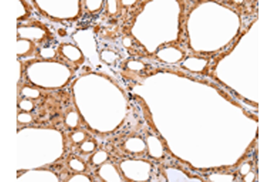 Immunohistochemistry - DEFB4A Antibody from Signalway Antibody (43259) - Antibodies.com
