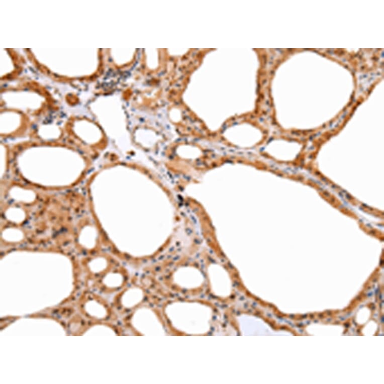 Immunohistochemistry - DEFB4A Antibody from Signalway Antibody (43259) - Antibodies.com