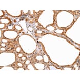 Immunohistochemistry - DEFB4A Antibody from Signalway Antibody (43259) - Antibodies.com
